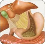 Realize band2 - Realize band2